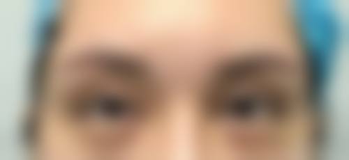 二、吴焱秋医学博士：20年专攻眼修复的"解剖学艺术家"