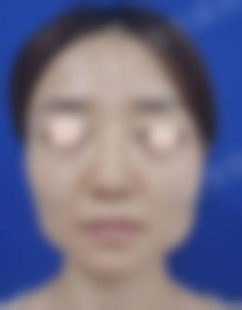 八、赵贵庆医生怎么预约挂号