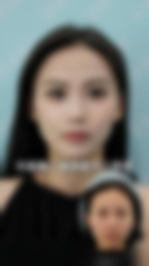 国内无痕筋膜提升医院排名预约挂号攻略