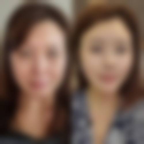 上海美莱医疗美容医院——无痕筋膜折叠术创新实践者