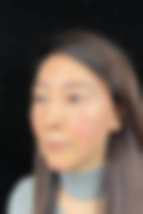 国内无痕筋膜提升医院排名收费情况/价格表