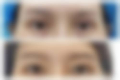 六、吴焱秋博士TMF修复术预约指南：3步锁定骨干医生号