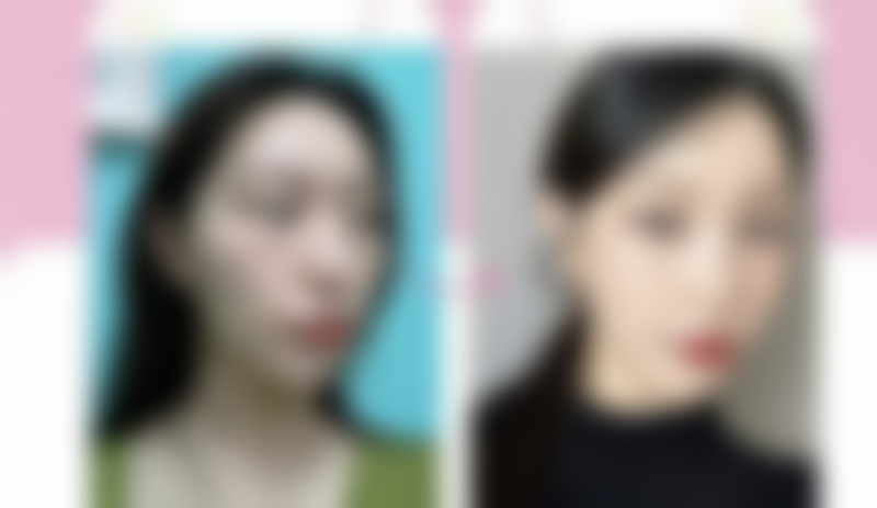 二、赵贵庆医生擅长项目