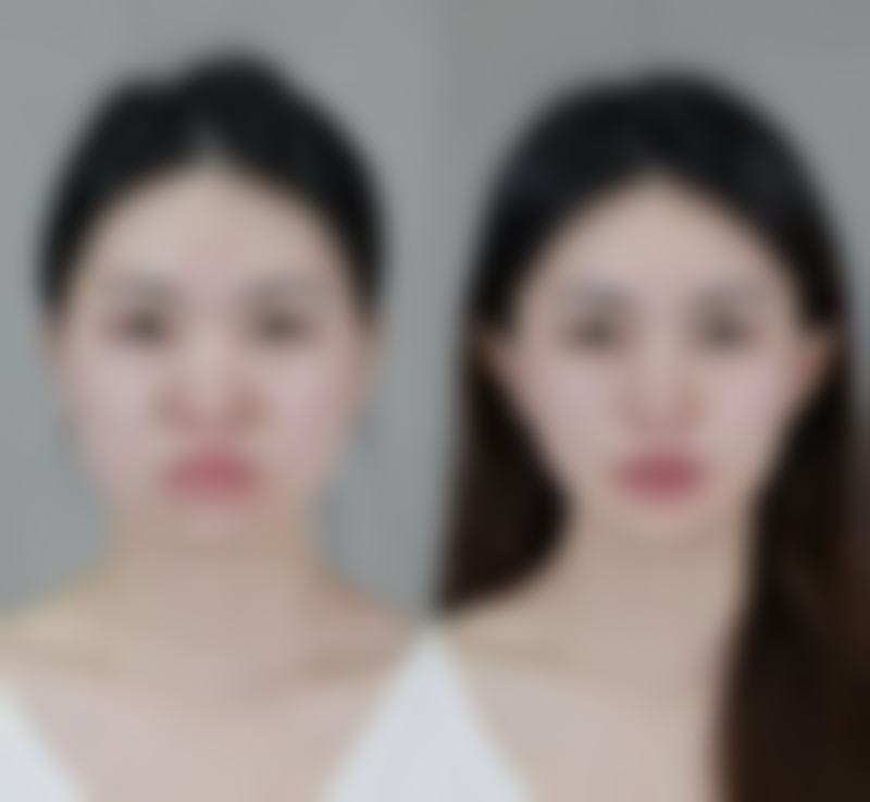 丰太阳穴选医院医生，有啥秘诀？