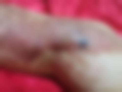 北京中亚医疗美容诊所真人口碑评价怎么样？