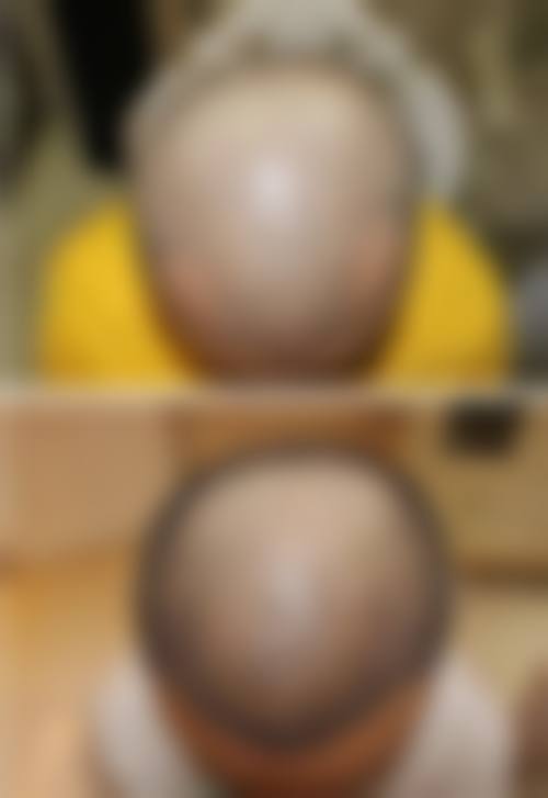 韩国爱林整形外科价格表