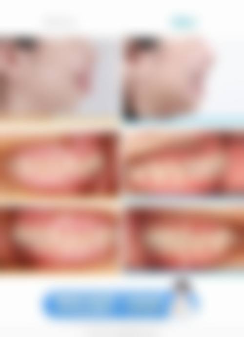 贵州凯里市月牙口腔诊所口碑如何