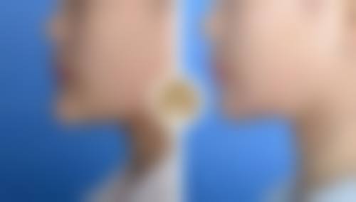 八、患者常见问题解答（精选 ）