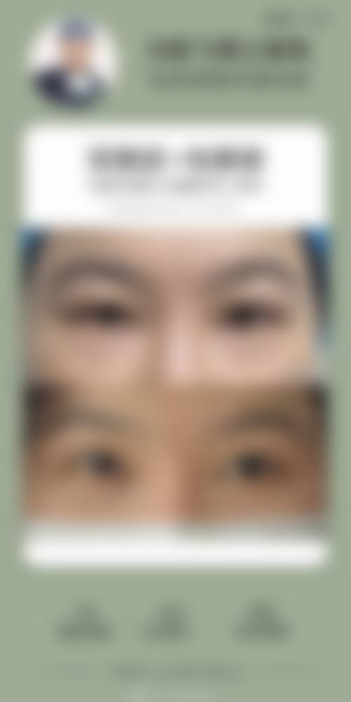 1. 肖乐强医生的眼部综合整形操作流程