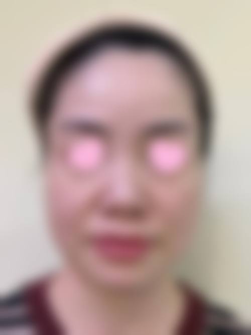 四、马炎医生技术优势与操作流程