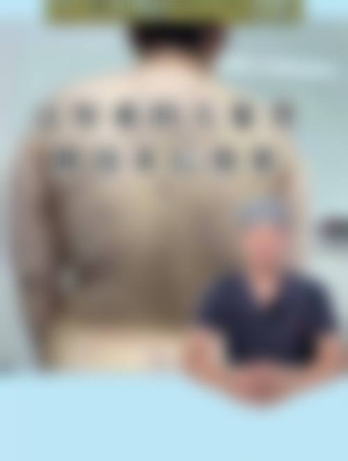 在决定是否选择抽脂前，普通用户更容易忽略的关键评估点