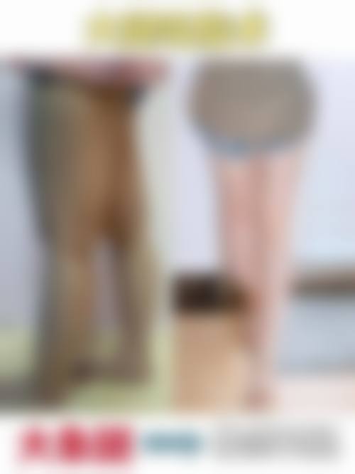 哪些人群在评估中更可能被建议考虑抽脂？