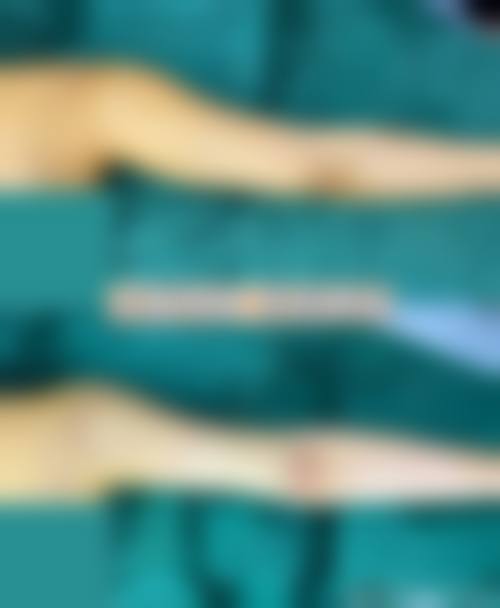 如果面部吸脂手术成效不理想，是否有补救与修复空间