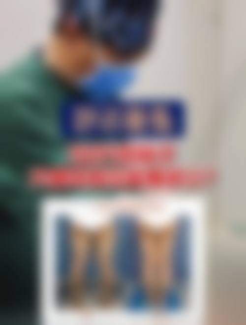 面部吸脂手术真实修复过程与不适时间线