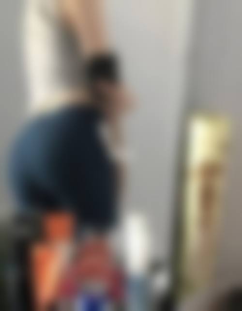 臀部吸脂后需留院情况：个体差异决定留院需求