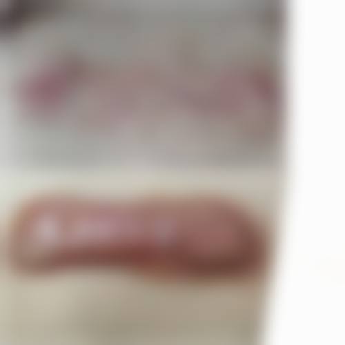 疤痕膏和疤痕贴配合使用的适用疤痕类型