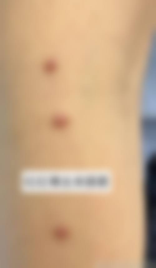 八、广州翊美医疗美容整形门诊部收费贵吗?