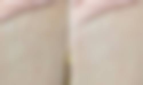 十一、西安爱特蜜医疗美容预约挂号