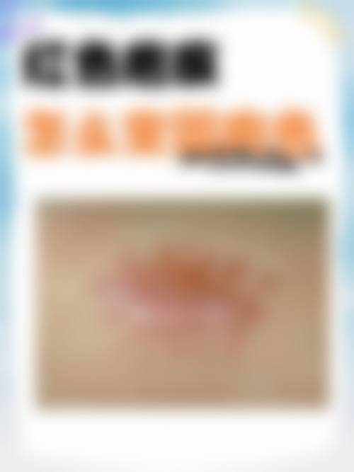 三、北京大学人民医院医疗美容科是国有医院吗？