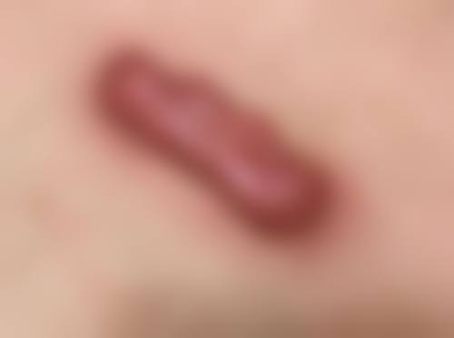 七、西安爱特蜜医疗美容技术优势