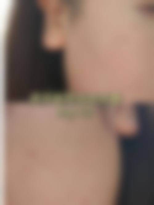 五、北京大学人民医院医疗美容科诊疗项目