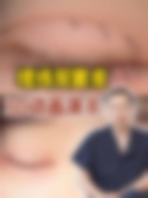 做双眼皮手术术前术后分别需要做好哪些准备和护理？