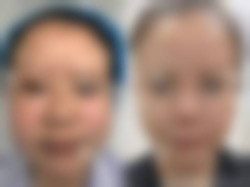 二、北京大学人民医院医疗美容科是正规医院