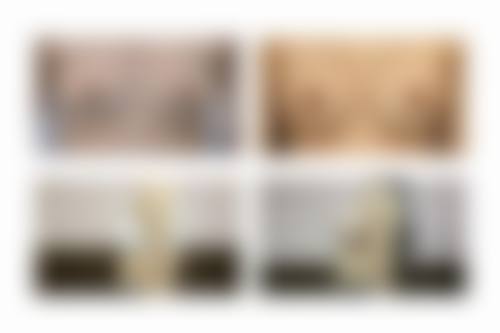 刚做过假体隆胸注意什么？三大护理要点（伤口清洁、拆线、引流管）与五大致敬生活禁忌全揭晓！ 