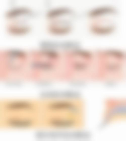 北方菠萝种植要点是什么？