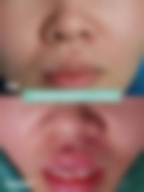 五、佳木斯博士丽整形外科门诊部真实实例参考