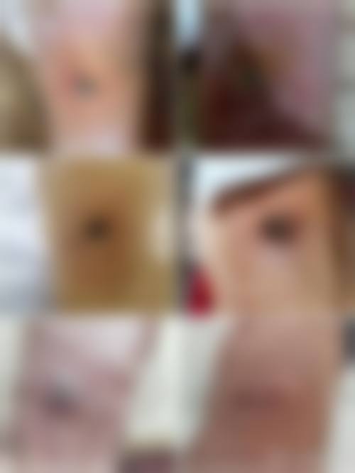 哪些情况通常不被认为是合适指征？