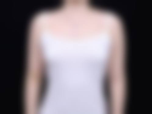 刚做过假体隆胸：真实修复过程与不适时间线