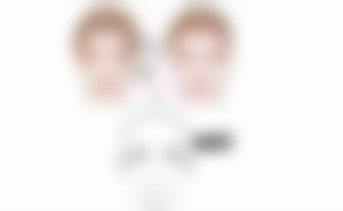 {种植发的方法有哪些？FUE无痕植发创口小、FUT有痕植发毛囊多，各有优势！附有痕无痕植发区别及5-20元/单位报价