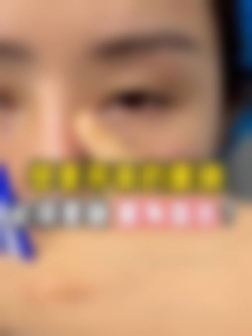 {双眼皮手术好不好？当然好！效果自然维持久，价格3000起，还能提升颜值气质！内切外切怎么选？医生亲授全攻略