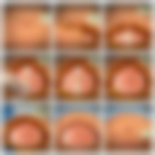 腰腹部抽脂效果明显吗？术后腰围减少5-10cm、皮肤紧致不松弛，真人案例对比图惊艳！