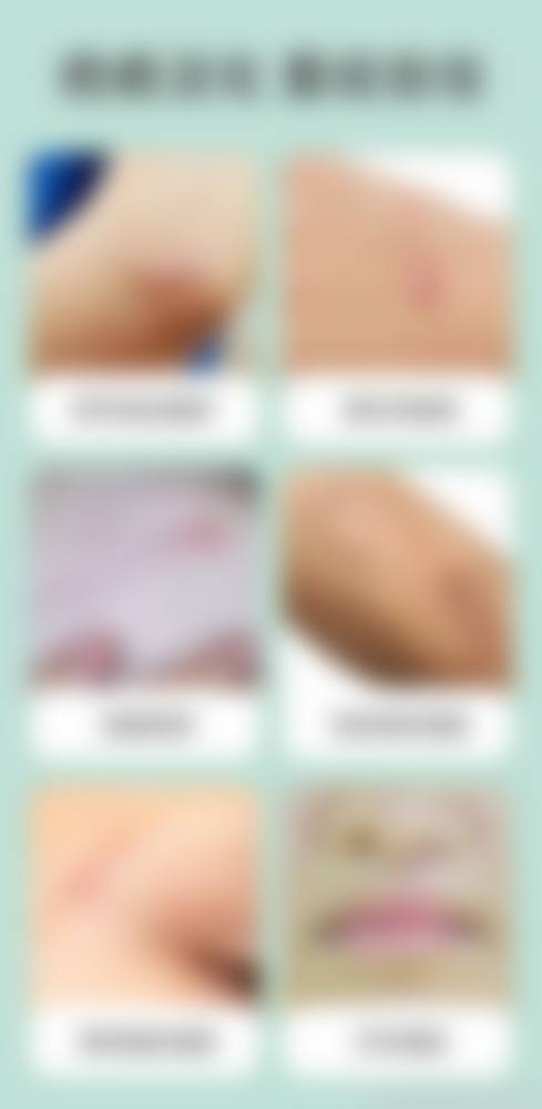 宁波蝶之美医疗美容诊所是正规医院吗？