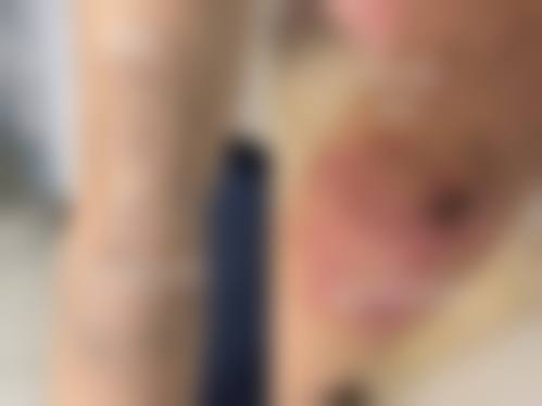 八、莆田英杰医疗美容诊所收费标准参考