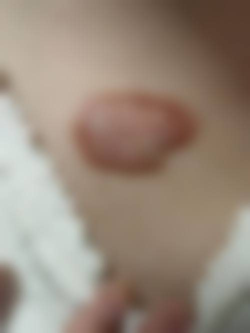 宁波蝶之美医疗美容诊所真人口碑评价怎么样？