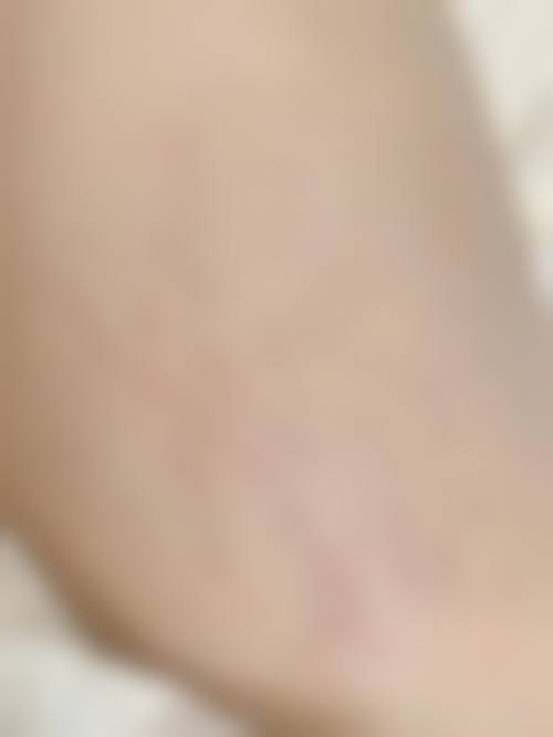 漳州芗城伊承黛整形医院预约挂号