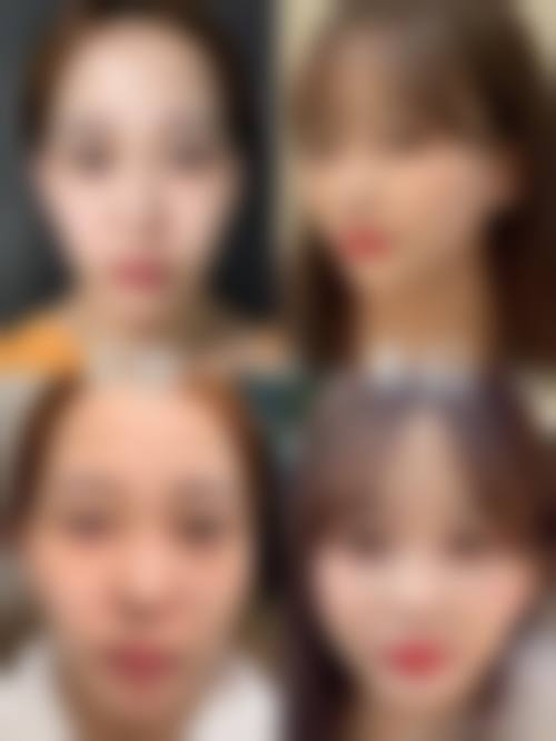 抽脂填充脸部的价格区间及费用差异来源