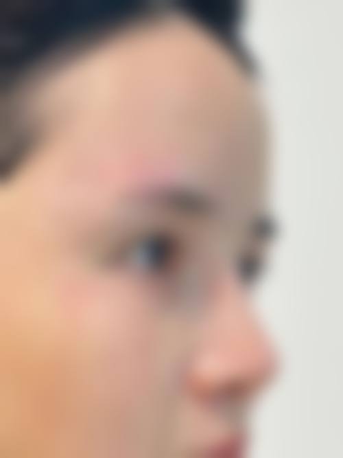 西安维美大眼睛医疗美容正规吗？