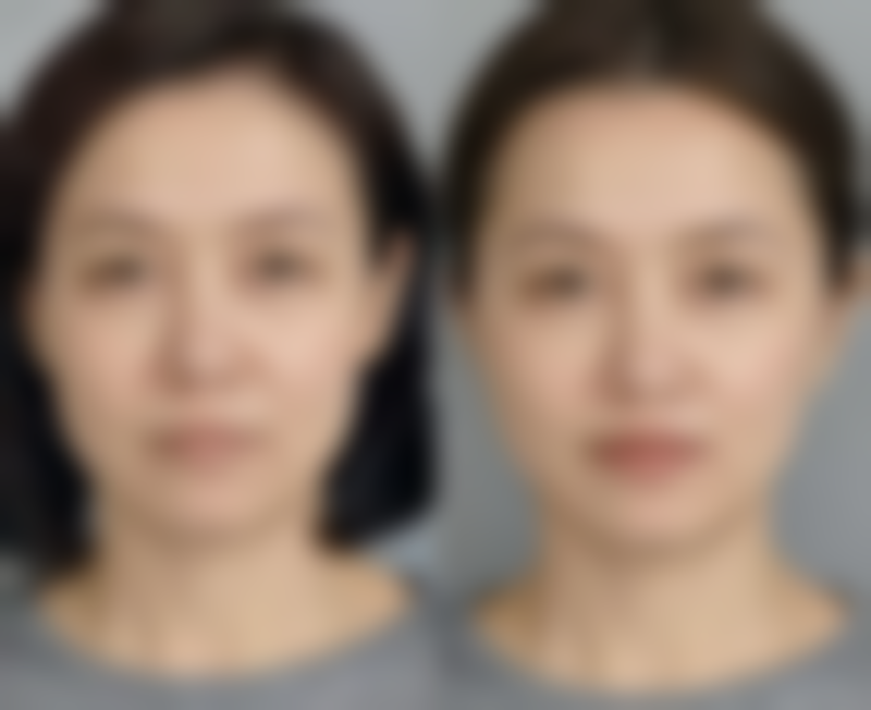 西安维美大眼睛医疗美容口碑如何？