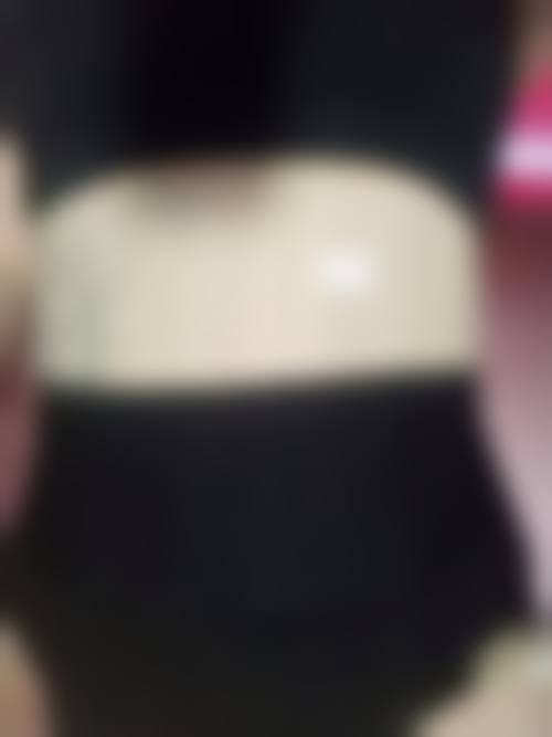 腰部抽脂减肥本身能解决什么、不能解决什么？