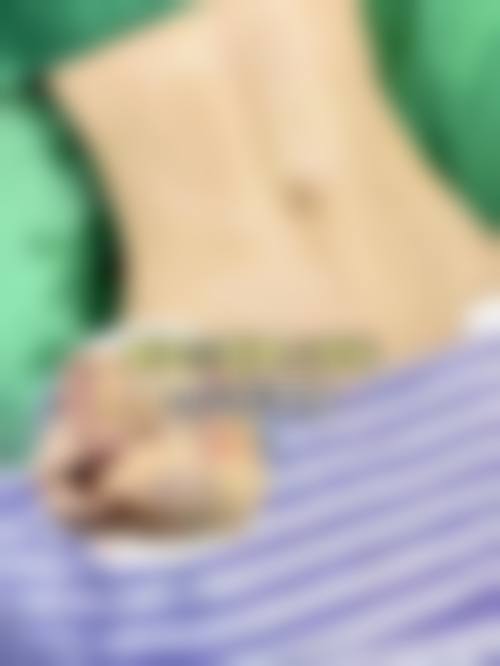 在决定是否选择腰部抽脂减肥前，普通用户更容易忽略的关键评估点