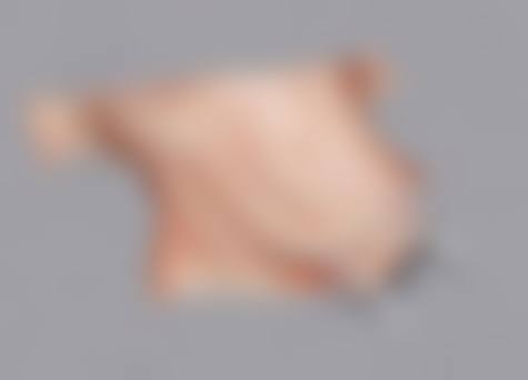 哪些情况通常不被认为是合适指征？