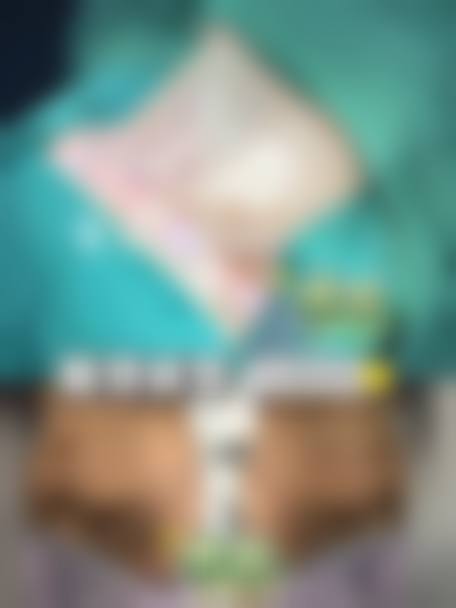 哪些人群在评估中更可能被建议考虑腰部抽脂减肥？