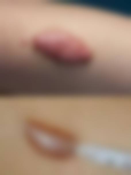 荆州伊莱美医疗美容门诊部诊疗项目