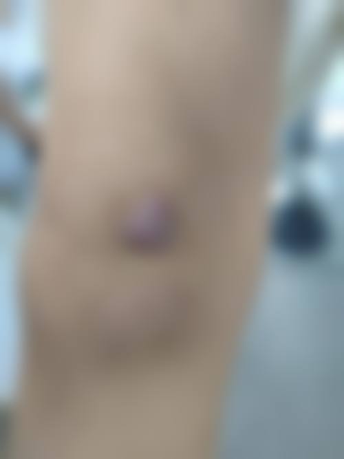 七、深圳欧亚美创医疗美容就诊预约挂号指南