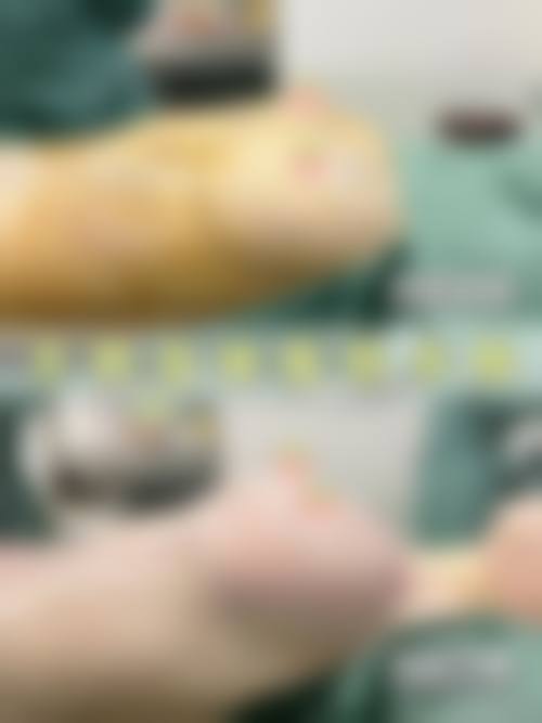 韩国MD胸部整形医院设备仪器