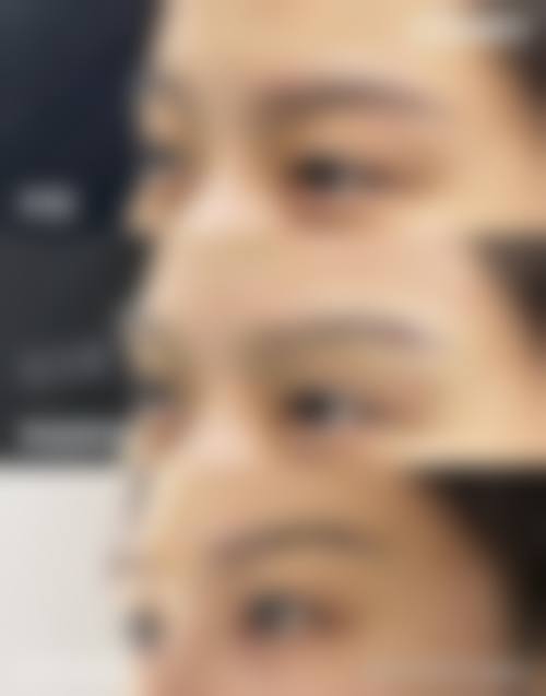 十、选择做完双眼皮拆线后护理相关医院与医生时，应重点看哪些维度？